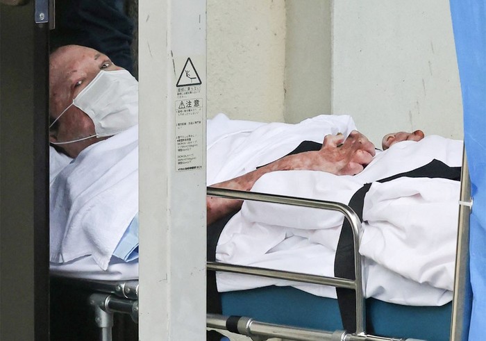(FILES) Shinji Aoba, who is suspected of the Kyoto Animation studio arson attack, looks up as he is transported on a stretcher to the Fushimi police station in Kyoto on May 27, 2020. A Japanese court found guilty on January 25, 2024 the perpetrator of a 2019 arson attack on an animation studio that killed 36 people, with sentencing expected later in the day, local media reported. (Photo by JIJI PRESS / AFP) / Japan OUT