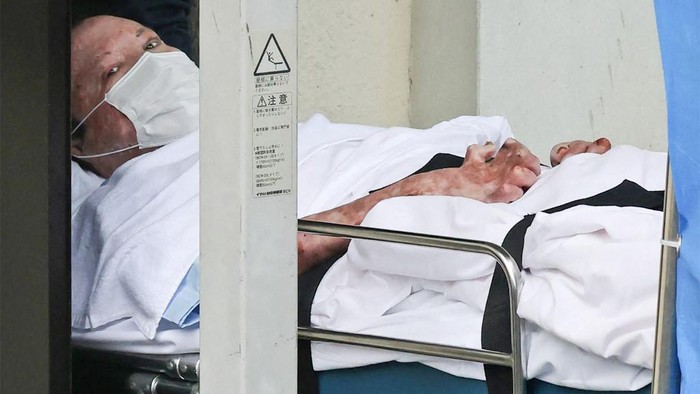 (FILES) Shinji Aoba, who is suspected of the Kyoto Animation studio arson attack, looks up as he is transported on a stretcher to the Fushimi police station in Kyoto on May 27, 2020. A Japanese court found guilty on January 25, 2024 the perpetrator of a 2019 arson attack on an animation studio that killed 36 people, with sentencing expected later in the day, local media reported. (Photo by JIJI PRESS / AFP) / Japan OUT