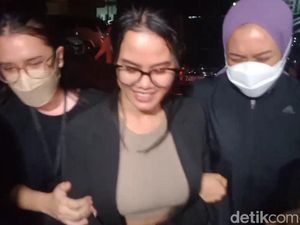 Kata Polisi soal Kondisi Kesehatan Siskaeee