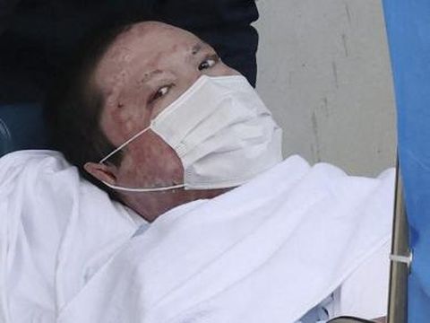 This picture taken on May 27, 2020 shows Shinji Aoba, the defendant in the Kyoto Animation arson murder case, being transported to a police station in Kyoto. (Photo by JIJI PRESS / AFP) / Japan OUT