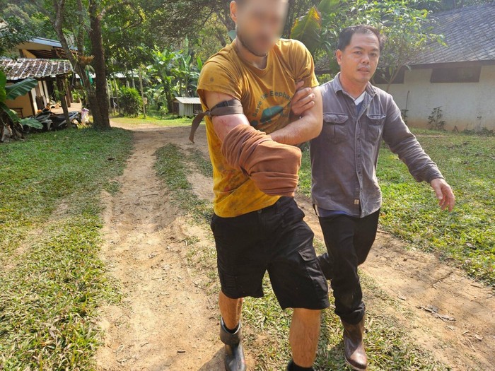 Relawan taman nasional digigit beruang