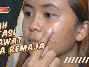 KuTips: 3 Saran Dokter Kulit untuk Obati Jerawat pada Remaja