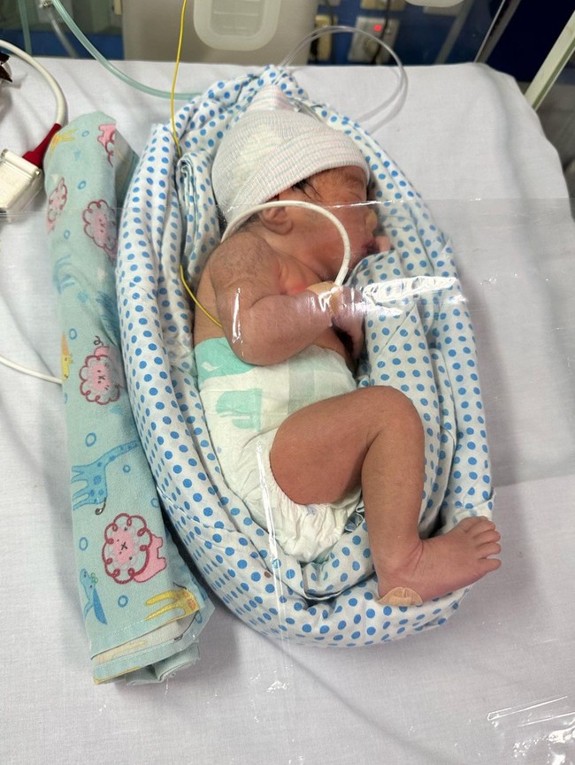 Lahir prematur pada 24 Januari 2024, anak kedua Cesen dan Marshel itu sempat terlilit tali pusar sebanyak 2 kali. Bayinya pun sempat harus dirawat dengan menggunakan oksigen. Foto: Instagram/@marshel_widianto