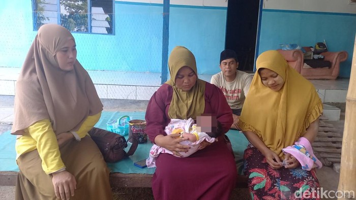 Bayi di Sampang lahir dengan 24 jari