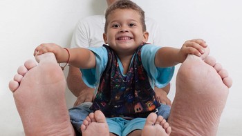 Jeison Orlando Rodríguez Hernandez memegang rekor memiliki kaki terbesar di dunia. Semasa kecil, ia kesulitan mencari sepatu yang pas dan harus memakai sandal yang terbuat dari ban dan kain bekas. Meskipun demikian, kakinya terus tumbuh dan diukur sekitar 40 cm pada tahun 2014. Saat ini ia menjalani perawatan untuk mencegah kakinya semakin membesar. Foto: Brightside