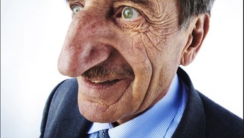 Bagi sebagian orang, hidung besar bisa menjadi alasan rasa tidak aman, namun bagi Mehmet Özyürek, hidungnya menjadi ciri unik yang membuatnya terkenal. Özyürek memiliki hidung terpanjang , berukuran 8,80 cm. Dia tidak pernah merasa perlu mengubahnya dan selalu senang memilikinya. Foto: Brightside