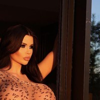 Implan payudara sebanyak 14 kali dikakukannya demi memenuhi obsesi tampilan ideal baginya. Dan seperti inilah tampilan dadanya yang terlihat tidak wajar. Foto: Dok. Instagram