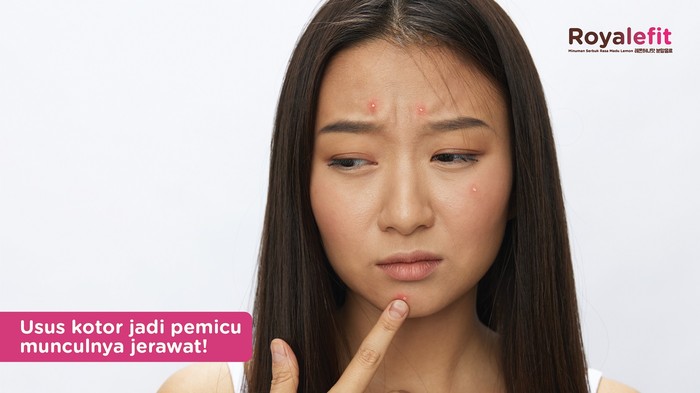 Usus Kotor Jadi Pemicu Munculnya Jerawat, Ini Penyebab dan Solusinya
