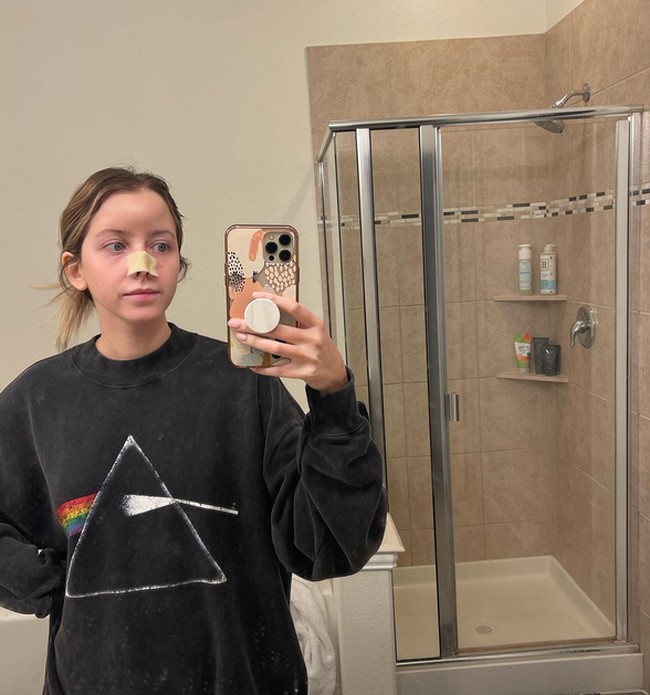 Anjing saudaranya yang menginap di rumahnya tiba-tiba mendekatinya. Awalnya anjing itu mendekati seolah-olah akan menjilati wajahnya tetapi malah dengan cepat menyerang. Foto: dok. Instagram/sincerelyjord