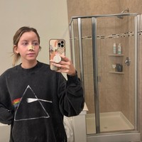 Anjing saudaranya yang menginap di rumahnya tiba-tiba mendekatinya. Awalnya anjing itu mendekati seolah-olah akan menjilati wajahnya tetapi malah dengan cepat menyerang. Foto: dok. Instagram/sincerelyjord