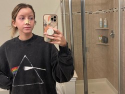 Foto Wanita Digigit Anjing Hingga Hidung Sobek, Ini Transformasi 10 Kali Oplas