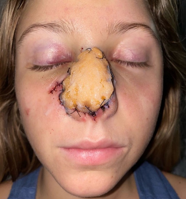 Dan seperti inilah penampakan Jordan setelah penyerangan anjing ras Boerboel itu.  Foto: dok. Instagram/sincerelyjord