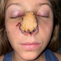 Dan seperti inilah penampakan Jordan setelah penyerangan anjing ras Boerboel itu.  Foto: dok. Instagram/sincerelyjord