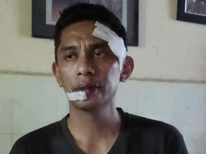 ASN di Kendari Diduga Dianiaya Sekretaris BPSDM Sultra, Polisi Selidiki