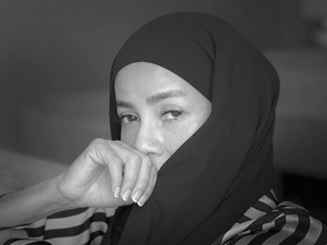 Olla Ramlan Alami Masalah di Leher dan Kulit Wajah