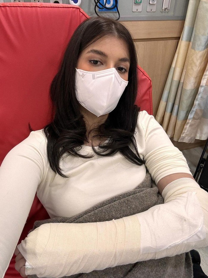 Sabrina Charunissa tangannya patah.