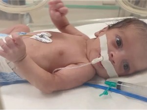 Kisah Pilu Anak-anak Gaza Jadi Yatim Piatu saat Perang Tak Sudah-sudah