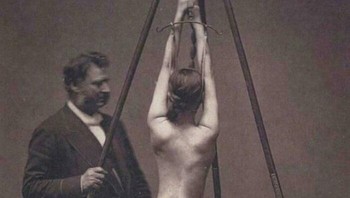 Lewis Sayre Mengobati Skoliosis, Memeriksa Kelengkungan Tulang Belakang - 1870-an Foto: Reddit via Boredpanda