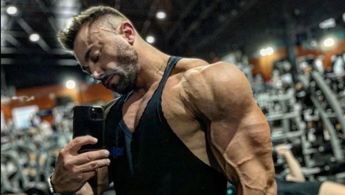 Pilu Binaragawan yang Lahir dengan 1 Ginjal Meninggal saat Antre Transplantasi