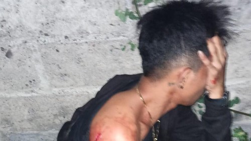 Korban penusukan sebelum dilarikan ke rumah sakit. (Dok. Polsek Densel)