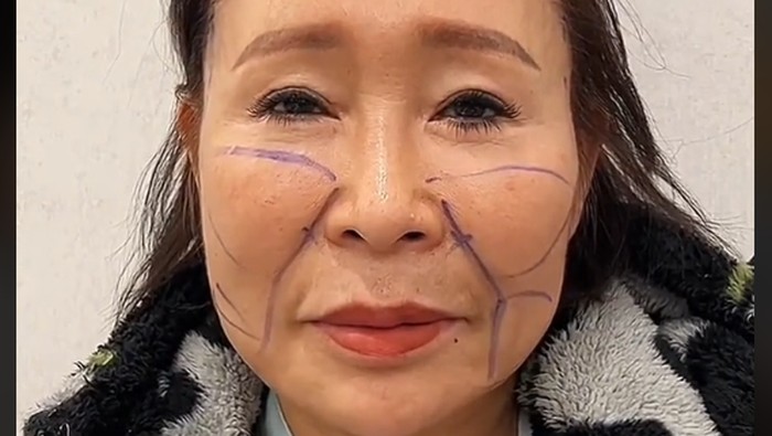 Pasien Dr. Kim