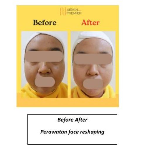 Foto: dok. Aiskin Premier