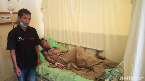 Ni Kadek Netri, perempuan penderita psoriasis di Karangasem, Bali, butuh uluran tangan orang baik.
