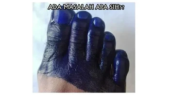 Bukan di kaki ya detikers... ingat di jari tangan. Foto: 1cak