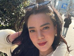 Alice Norin Bersyukur Operasi Kanker Sarkoma Berjalan Lancar