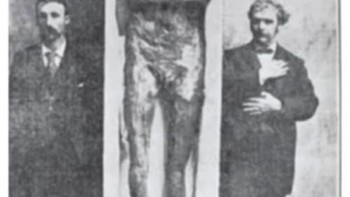 Keaslian gambar ini belum dapat ditentukan, namun para ahli sepakat bahwa raksasa dalam foto tersebut terlihat sangat nyata. Kerangka raksasa ini ditemukan pada tahun 1912 di Danau Delavan, Wisconsin. Namun temuan arkeologis yang mencengangkan ini hanyalah satu dari lusinan penemuan serupa yang dilaporkan di sekitar kawasan tersebut sejak tahun 1851. Pada tanggal 20 Desember 1897, misalnya, Times menulis laporan tentang tiga gundukan kuburan besar yang ditemukan di Maple Creek, Wisconsin. Foto: Trueactivist