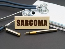 Kisah Pria Didiagnosis Kanker Ginjal Stadium 4B hingga Akhirnya Sembuh