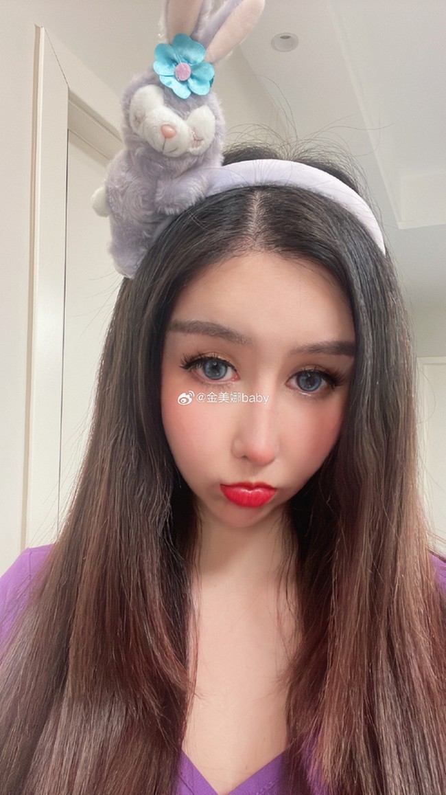 Perawatan wajah bahkan operasi plastik sering dilakukan para artis. Tapi perubahan pada wajah Jin Mei Na disebut gagal karena terlihat kurang mulus. Foto: Dok. Weibo