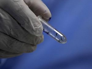 Apa itu Epidemiologi? Simak Pengertian, Tujuan, hingga Jenis-jenisnya