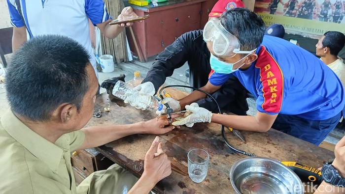 Petugas damkar Pamekasan saat mengeluarkan cincin dari jari Ramli