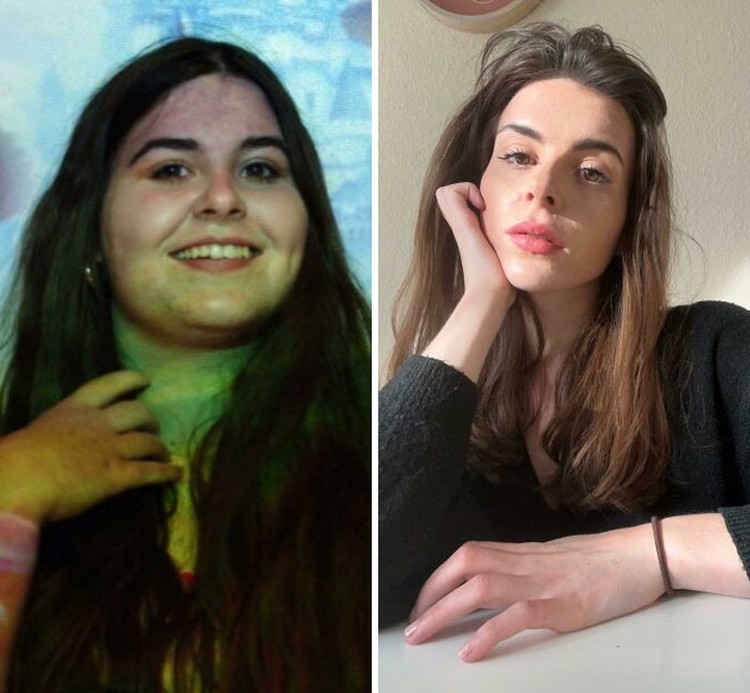 Foto Sebelum dan Sesudah Menurunkan Berat Badan