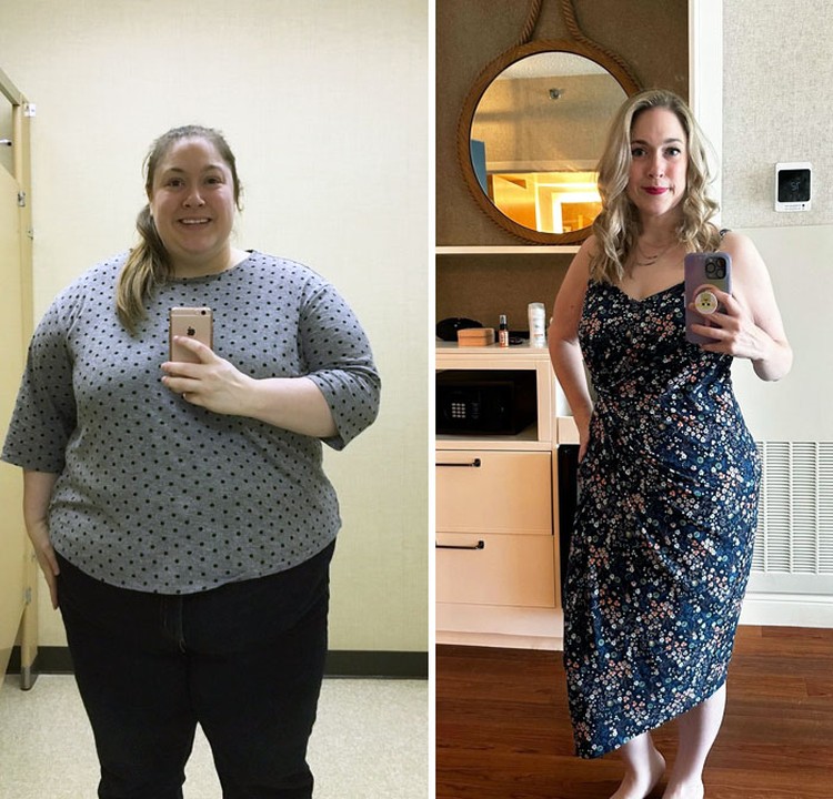 Foto Sebelum dan Sesudah Menurunkan Berat Badan