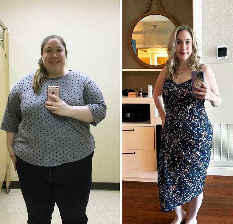 Foto Sebelum dan Sesudah Menurunkan Berat Badan