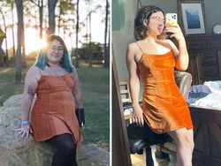 Foto Sebelum dan Sesudah Menurunkan Berat Badan Bikin Tercengang