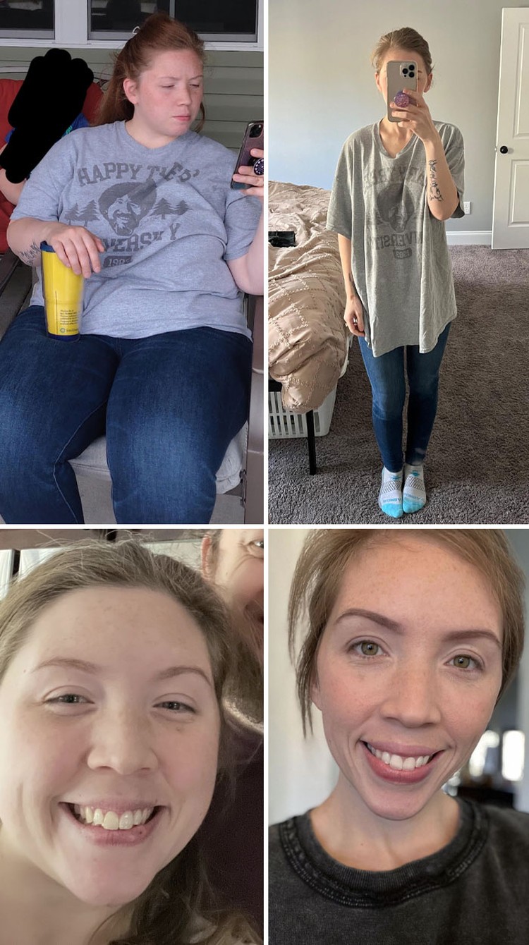 Foto Sebelum dan Sesudah Menurunkan Berat Badan Foto Sebelum dan Sesudah Menurunkan Berat Badan