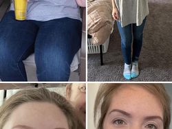 Foto Sebelum dan Sesudah Menurunkan Berat Badan Bikin Tercengang