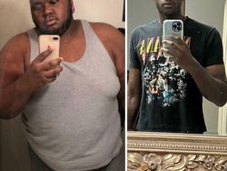 Foto Sebelum dan Sesudah Menurunkan Berat Badan Bikin Tercengang