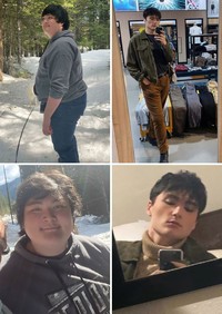 Foto Sebelum dan Sesudah Menurunkan Berat Badan