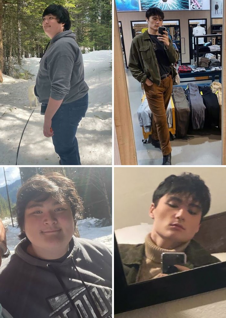 Foto Sebelum dan Sesudah Menurunkan Berat Badan