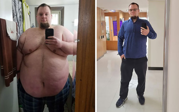 Foto Sebelum dan Sesudah Menurunkan Berat Badan