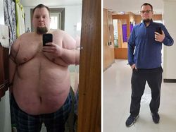 Foto Sebelum dan Sesudah Menurunkan Berat Badan Bikin Tercengang