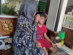 Tak Cukup Bukti Bikin Kasus Saraf Retina Anak Polisi Jombang Rusak Disetop