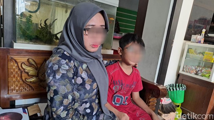 Siswa SD anak polisi di Jombang yang kena pecahan gagang sapu hingga retina matanya rusak dan mengalami glaukoma.