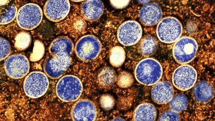 Alaskapox adalah anggota genus Orthopoxvirus, yang mencakup virus mpox.
