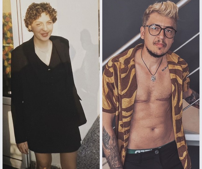 Inilah foto before after Taylor saat menjadi wanita dan bertransisi sebagai pria. Pria asal Inggris itu menjalani pengangkatan payudara di 2019. Kemudian di 2023, Taylor melakukan pengangkatan rahim.  Foto: Dok. Instagram