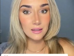 Kisah Wanita Diet Ekstrem Hanya Minum Air Selama 5 Hari, Tubuhnya Jadi Begini